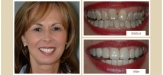 smile-gallery